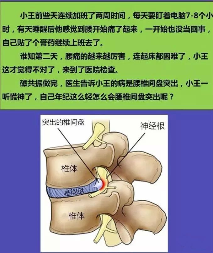 腰椎间盘出膨出(腰椎间盘出膨出是什么原因)