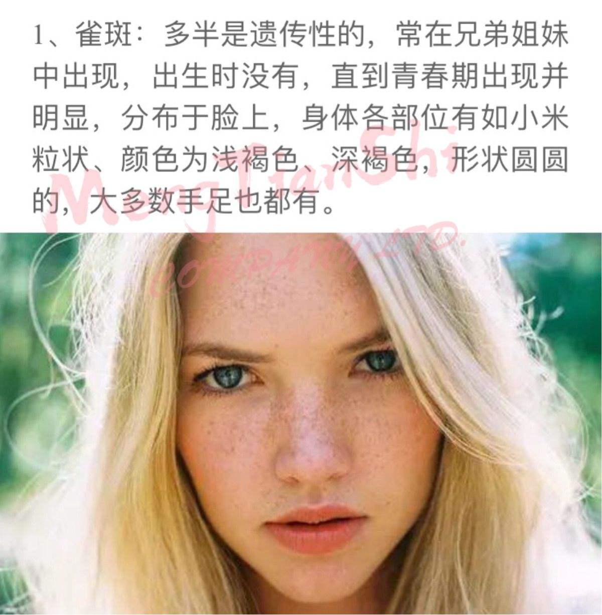 脸上突然长斑是什么原因引起的(脸上突然长斑是什么原因引起的百度)