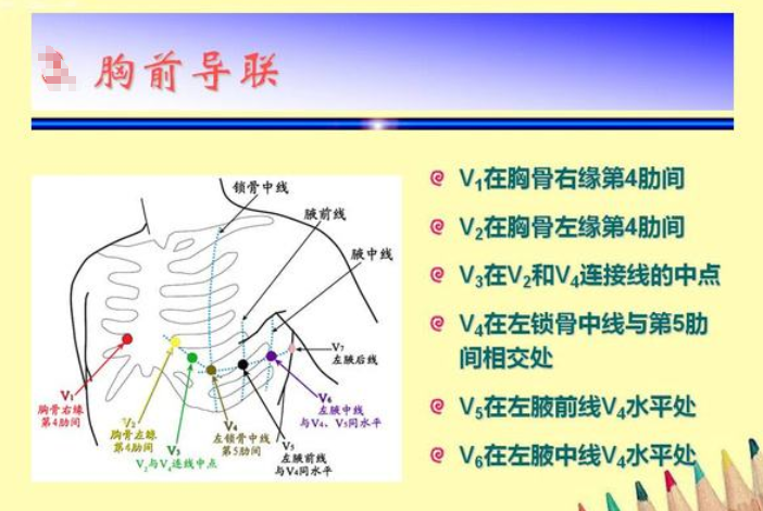 18导联心电图位置顺序(18导联心电图位置顺序口诀)