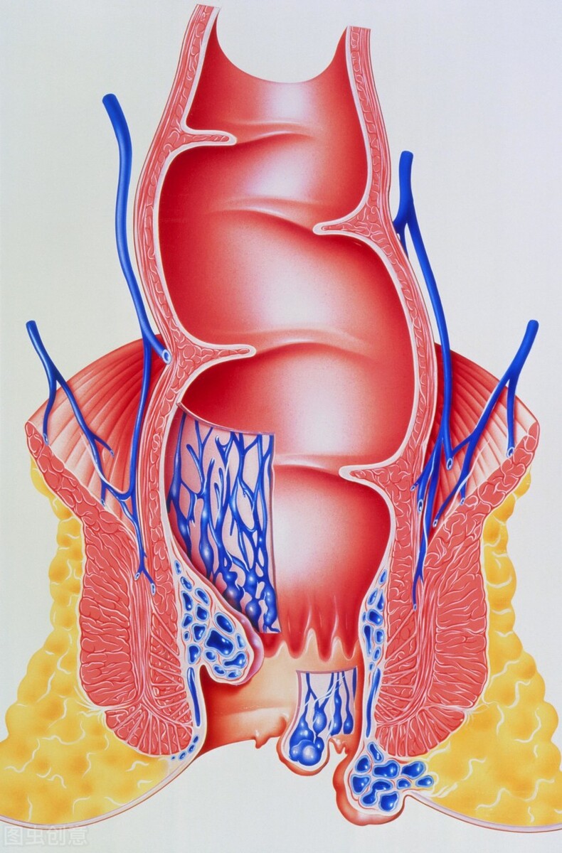 痔疮便血会怎么样(痔疮便血会怎么样?)