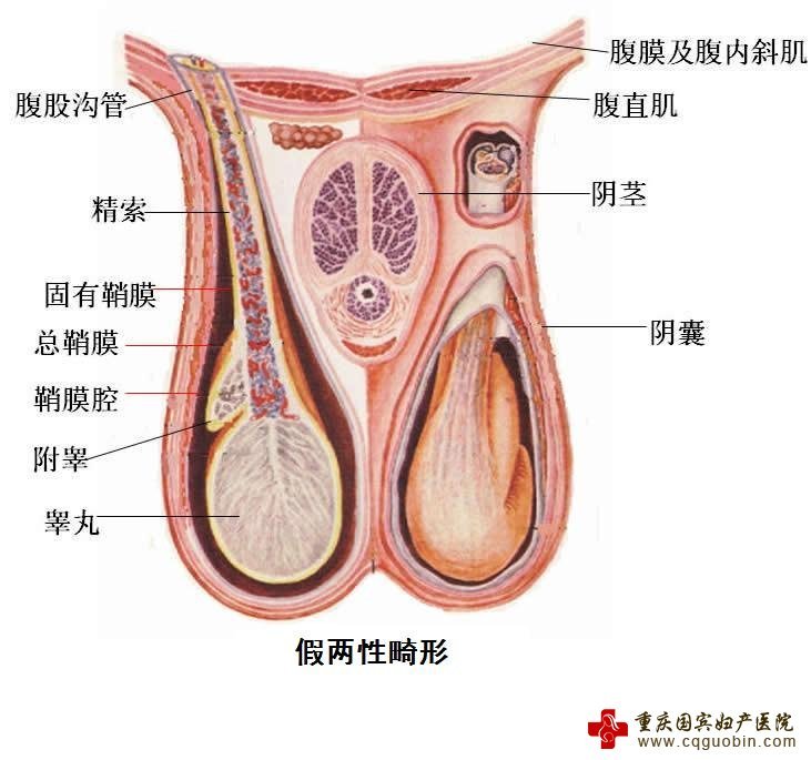 两性畸形患者可以怀孕么(两性畸形可以治好吗)