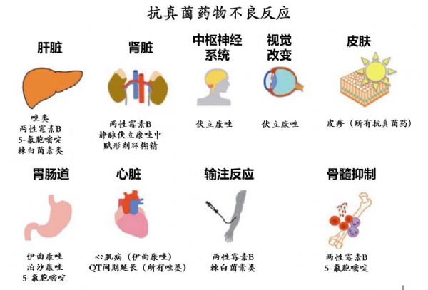 两性霉素B神经梅毒(两性霉素b最常见的急性毒性反应是)