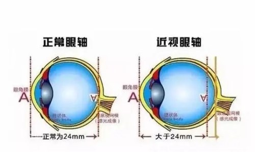 眼睛散光是什么症状(夜间开车眼睛散光是什么症状)