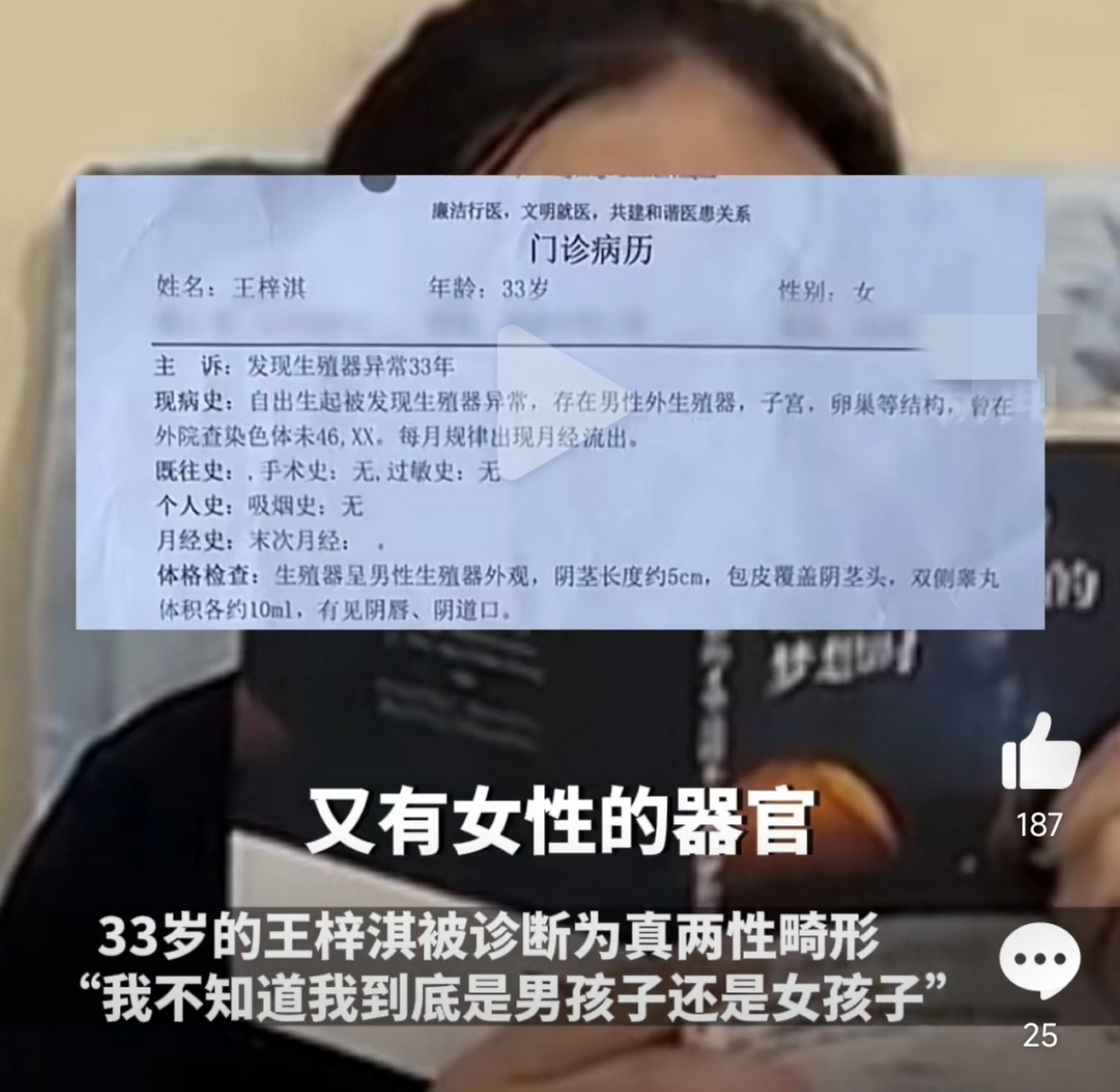 两性畸形的小孩还有救么(两性畸形可以生孩子下来吗)