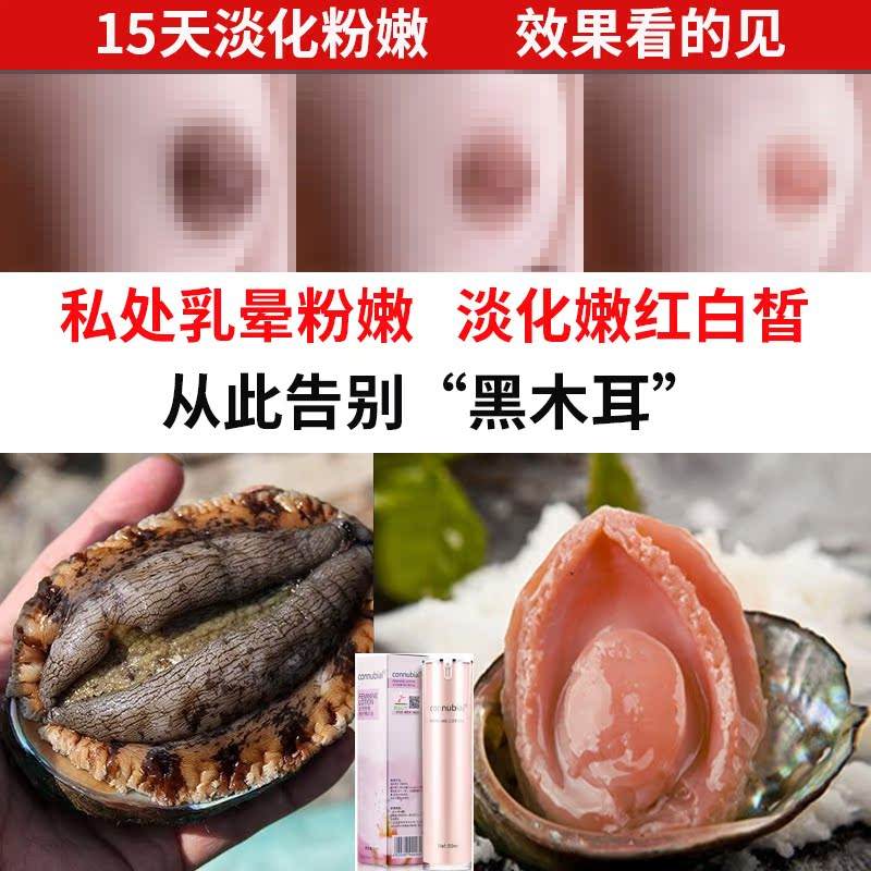 乳头变黑(乳头变黑还有点疼是什么原因)